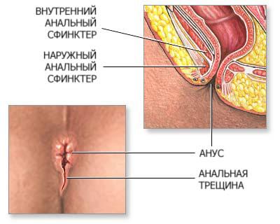 "Анальная